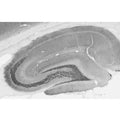 Adult rat hippocampus immunohistochemistry.