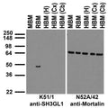 Immunoblot against crude membrane fractions from whole mouse (MBM) or rat (RBM) brain and from human hippocampus [HBM(H)], cerebral cortex [HBM(Cx)] or cerebellum [HBM(Cb)] and probed with K51/1 (left) or N52A/42 (right) TC supe.