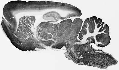 Adult rat brain immunohistochemistry.