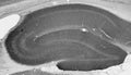 Adult rat hippocampus immunohistochemistry.