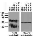 Immunoblot against crude membrane fractions from whole mouse (MBM) or rat (RBM) brain and from human hippocampus [HBM(H)], cerebral cortex [HBM(Cx)] or cerebellum [HBM(Cb)] and probed with N7/18 (left) or N52A/42 (right) TC supe.