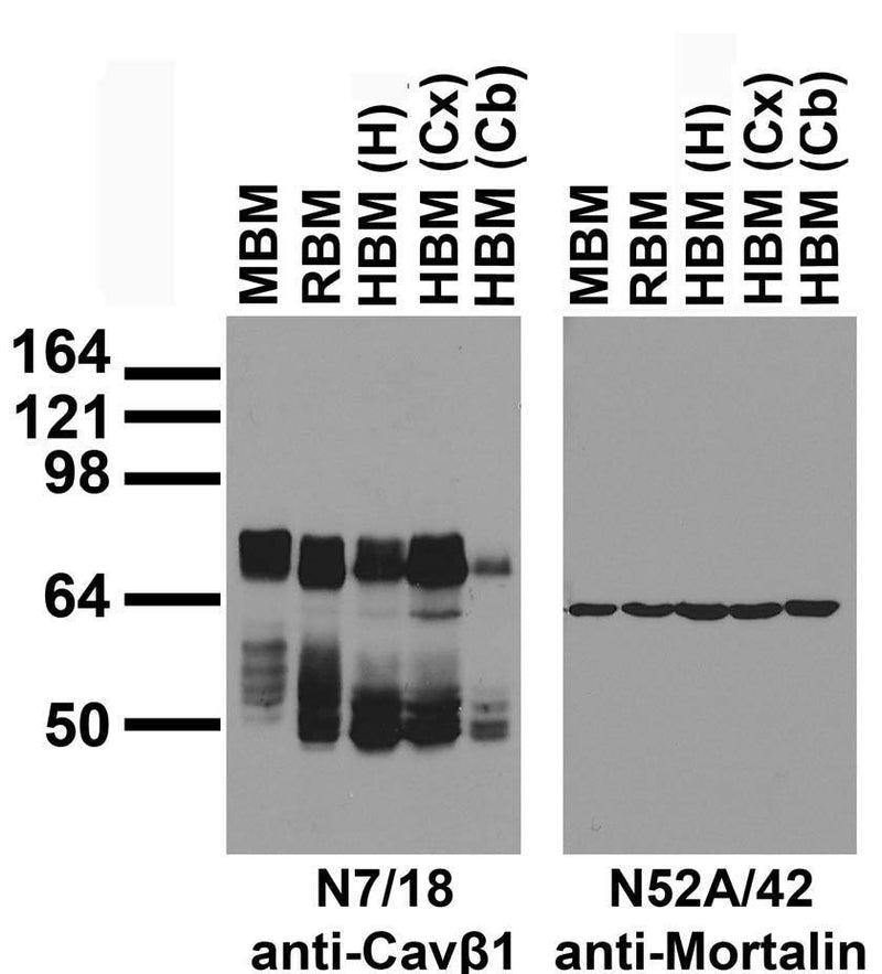Immunoblot against crude membrane fractions from whole mouse (MBM) or rat (RBM) brain and from human hippocampus [HBM(H)], cerebral cortex [HBM(Cx)] or cerebellum [HBM(Cb)] and probed with N7/18 (left) or N52A/42 (right) TC supe.