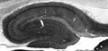 Adult rat hippocampus immunohistochemistry.