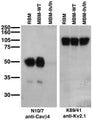 Immunoblot on adult rat brain membrane (RBM), and adult mouse brain membranes (MBM) from wild-type (WT) and lethargic (lh/lh) mice (left) Lethargic mice courtesy of Dr. Jeff Noebels, Baylor College of Medicine.