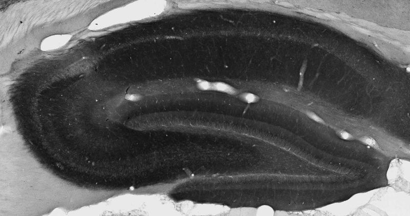 Adult rat hippocampal immunohistochemistry.