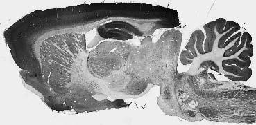 Adult rat whole brain immunohistochemistry.