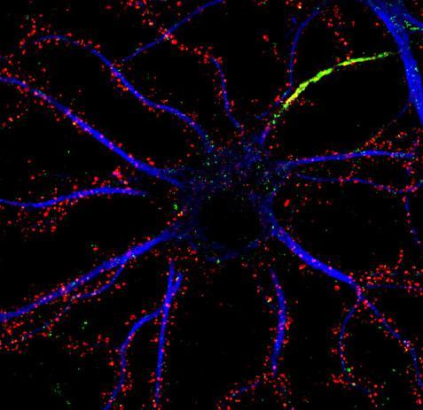 Immunofluorescence staining of cultured rat hippocampal neurons with N18/30 (red), K13/31 (Kv1.4, green) and rabbit anti- MAP2 (blue). Image courtesy of Yasuhiro Ogawa and Matthew Rasband (Baylor College of Medicine).