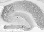Adult rat brain hippocampus immunohistochemistry.