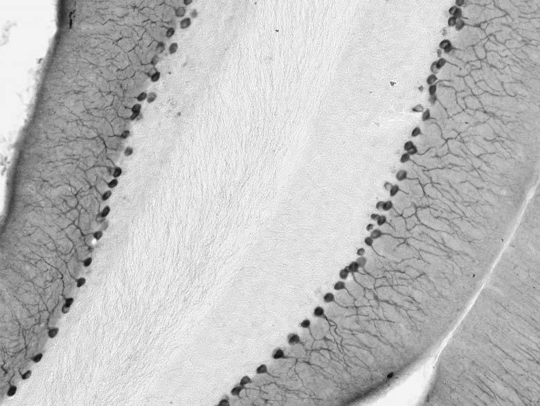 Cerebellum immunohistochemistry.