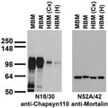Immunoblot against crude membranes from whole adult mouse brain (MBM) or rat brain (RBM) and from human cerebral cortex [HBM(Cx)] or hippocampus [HBM(H)] probed with N18/30 (left) or N52A/42 (right) TC supe.