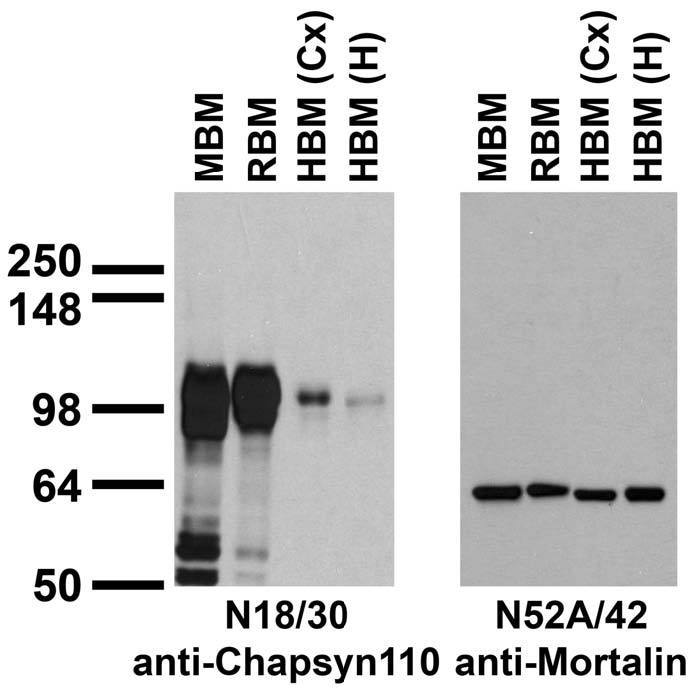 Immunoblot against crude membranes from whole adult mouse brain (MBM) or rat brain (RBM) and from human cerebral cortex [HBM(Cx)] or hippocampus [HBM(H)] probed with N18/30 (left) or N52A/42 (right) TC supe.