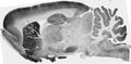 Adult rat brain immunohistochemistry (with antigen retrieval via sodium citrate pretreatment).