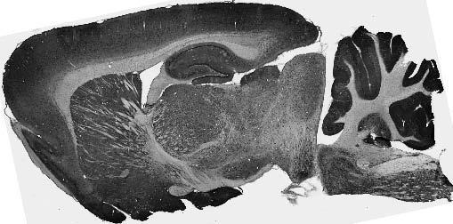 Adult rat brain immunohistochemistry (with antigen retrieval via sodium citrate pretreatment.