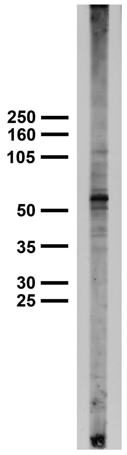 Adult rat brain low-speed pellet immunoblot.