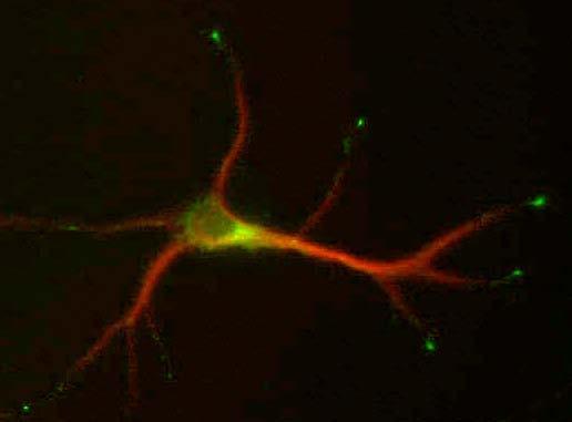 Cultured hippocampal neurons (9 DIV) double- Stained for MAP2 (red), L5/1 (green).