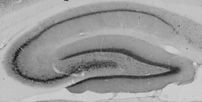 Adult rat hippocampus immunohistochemistry.