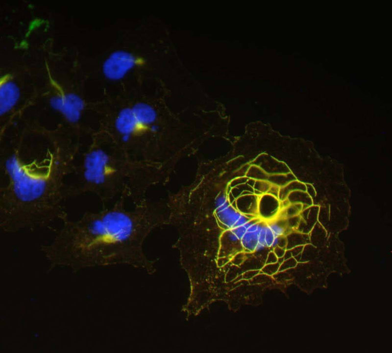 Transfected cell immunofluorescence staining N22/21=green, rabbit anti-Shank1=red, DAPI=blue.