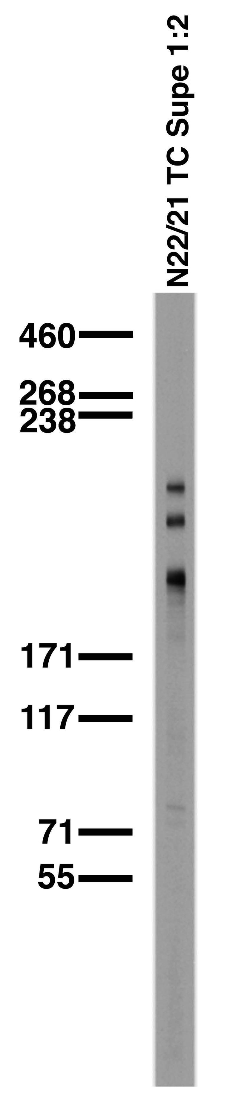 Adult rat brain membrane immunoblot.