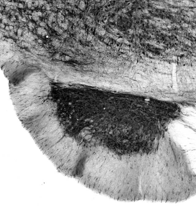 Adult rat pontine nucleus immunohistochemistry.
