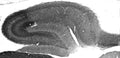 Adult rat hippocampus immunohistochemistry.