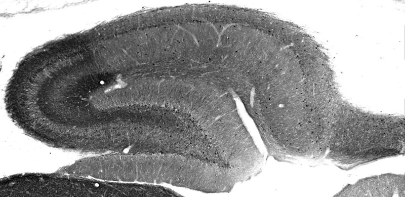 Adult rat hippocampus immunohistochemistry.
