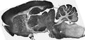Adult rat brain immunohistochemistry.