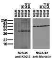 Immunoblot against crude membrane fractions from whole mouse (MBM) or rat (RBM) brain and from human hippocampus [HBM(H)], cerebral cortex [HBM(Cx)] or cerebellum [HBM(Cb)] and probed with N25/35 (left) or N52A/42 (right) TC supe.