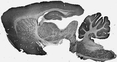 Adult rat brain immunohistochemistry.