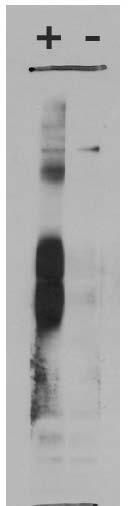 Transfected cell immunoblot: extracts of CV-1 fibroblast cells transfected with VGlut3 (+) or left untransfected (-) and probed with N34/34 TC supe. Image courtesy of Jeff Erickson, Louisiana State University Health Sciences Center.