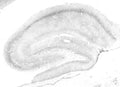 Adult rat hippocampus immunohistochemistry.
