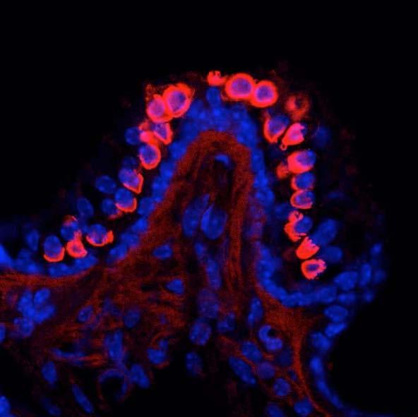 Mouse cochlea immunofluorescence. Labeling in crista ampullaris. Red = N43/6, Blue = Hoechst nuclear stain. Courtesy of Ms. Gesa Rickheit and Dr. Thomas Jentsch, Max-Delbrueck-Centrum fuer Molekulare Medizin, Berlin, Germany.