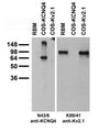 Adult rat brain membrane (RBM) and transfected cell immunoblot: extracts of RBM (left lane) and COS-1 cells transiently transfected with KCNQ4 (middle lane) or Kv2.1 (right lane) plasmids and probed with pure N43/6 (left panel) or K89/41 TC supe (right panel).