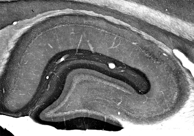 Adult rat hippocampus immunohistochemistry.