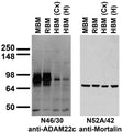 Immunoblot versus brain membranes from whole rat (RBM) and mouse (MBM) brain, and from human cerebral cortex [HBM(Cx)] and hippocampus [HBM(H)].