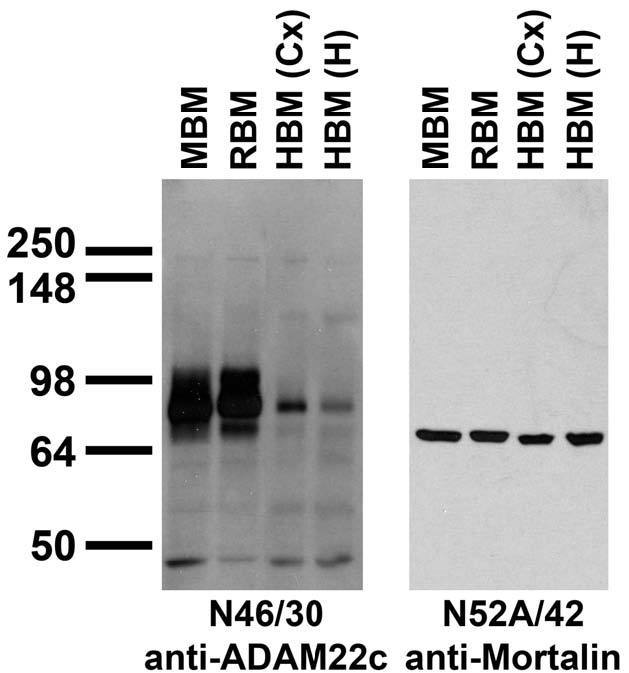 潜伏期間「Incubation.」CD Anti-ADAM22 (Cytoplasmic) Antibody (N46/30) | 75-083