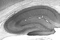 Adult rat hippocampus immunohistochemistry.