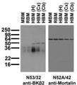 Immunoblot against crude membrane fractions from whole mouse (MBM) or rat (RBM) brain and from human hippocampus [HBM(H)], cerebral cortex [HBM(Cx)] or cerebellum [HBM(Cb)] and probed with N53/32 (left) or N52A/42 (right) TC supe.