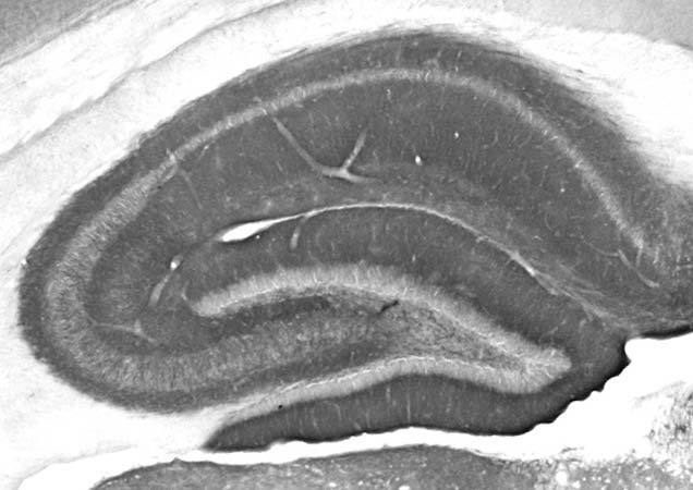 Adult rat hippocampus immunohistochemistry.