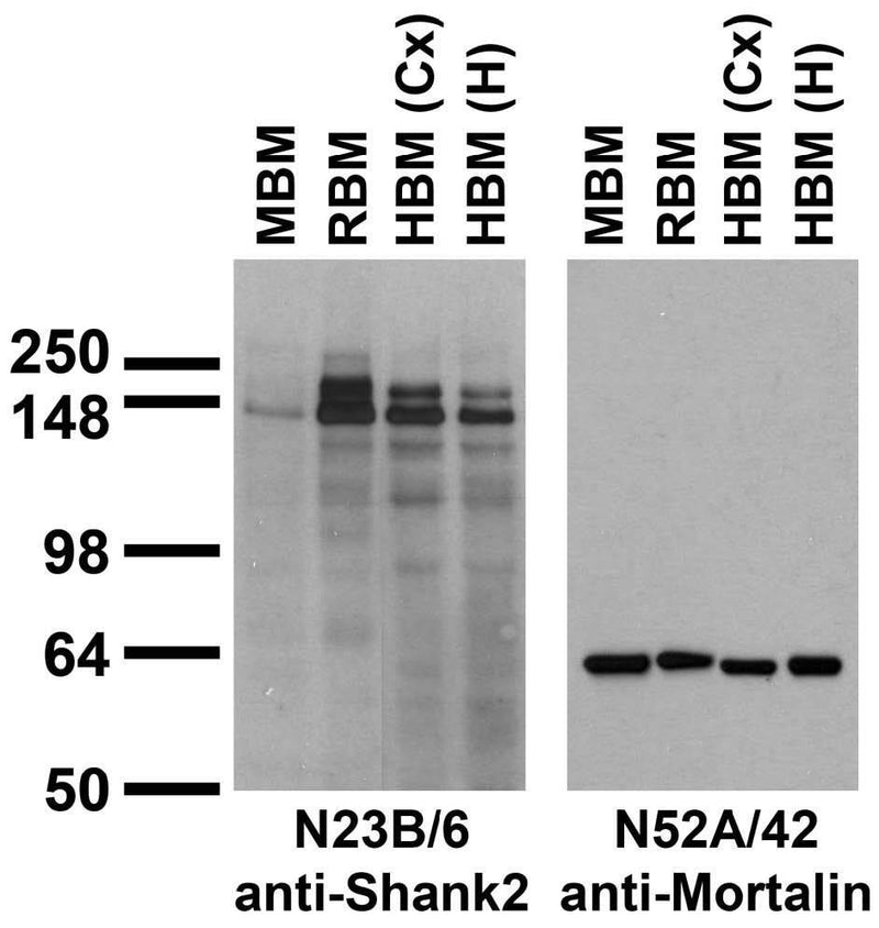 Immunoblots on brain membranes prepared from whole rat (RBM) and mouse (MBM) brain, and from human cerebral cortex [HBM(Cx)] and hippocampus [HBM(H)].
