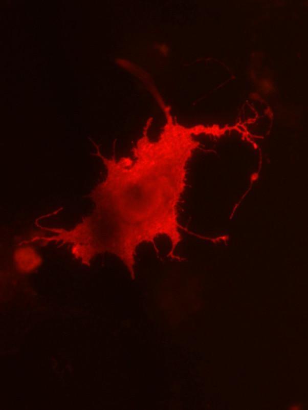 Transfected cell immuno- fluorescence showing unpermeabilized COS-1 cells expressing ADAM22.