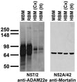 Immunoblot versus brain membranes from whole rat (RBM) and mouse (MBM) brain, and from human cerebral cortex [HBM(Cx)] and hippocampus [HBM(H)].
