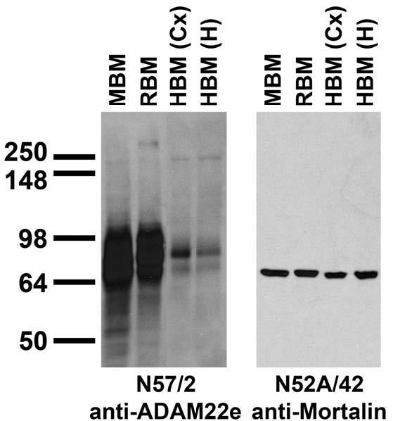 Immunoblot versus brain membranes from whole rat (RBM) and mouse (MBM) brain, and from human cerebral cortex [HBM(Cx)] and hippocampus [HBM(H)].