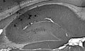 Adult rat hippocampus immunohistochemistry.