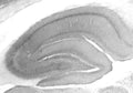 Adult rat hippocampus immunohistochemistry.