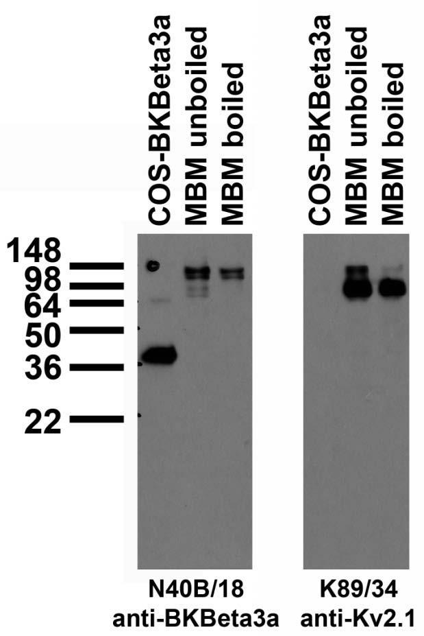 Immunoblot versus COS lysate and mouse brain membranes (MBM), probed with N40B/18 (left panel) and N89/34 (right panel) TC supe.