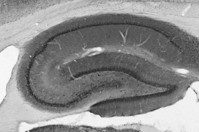 Adult rat hippocampus immunohistochemistry.