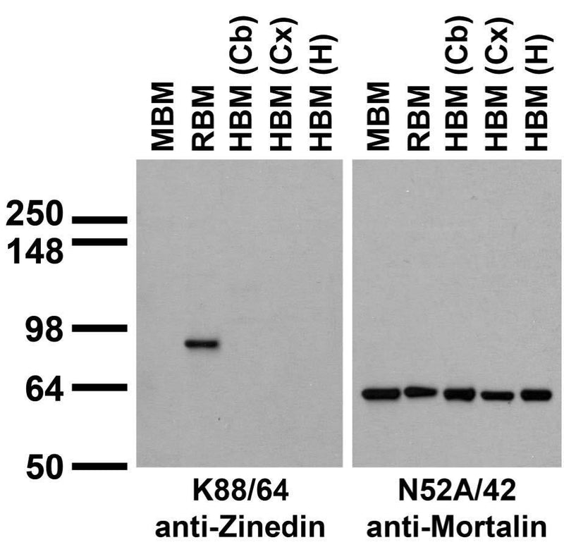 Immunoblots on brain membranes prepared from whole rat (RBM) and mouse (MBM) brain, and from human cerebral cortex [HBM(Cx)] and hippocampus [HBM(H)]..