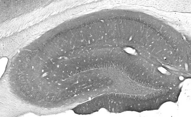 Adult rat hippocampus immunohistochemistry.