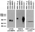 Immunoblot versus lysates of whole rat brain (WBH) and of COS-1 cells transfected with human and rat MMP9 (hMMP9 and rMMP9, respectively) and Kv2.1 plasmids and probed with L51/82 (left), K89/34 (middle) and loading control (right) TC supe.