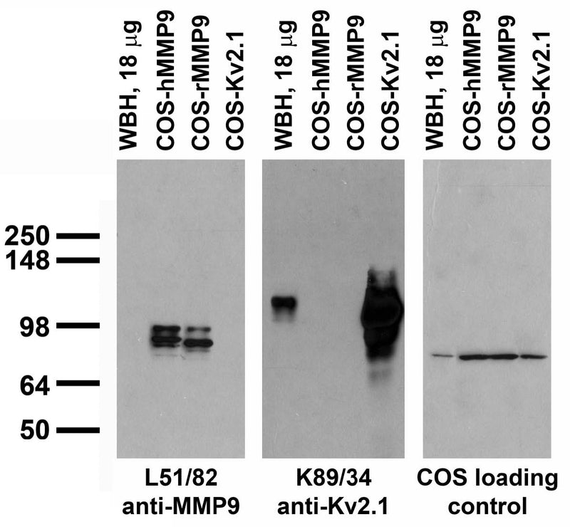 Immunoblot versus lysates of whole rat brain (WBH) and of COS-1 cells transfected with human and rat MMP9 (hMMP9 and rMMP9, respectively) and Kv2.1 plasmids and probed with L51/82 (left), K89/34 (middle) and loading control (right) TC supe.
